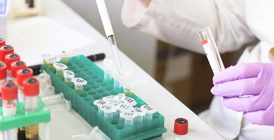 Successful management of postoperative recurrence of hepatocellular carcinoma with p53 gene therapy combining transcatheter arterial chemoembolization