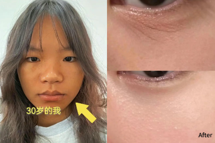 30+ Face sagging, energy collapse? The "anti-aging special forces" hidden in your body can actually