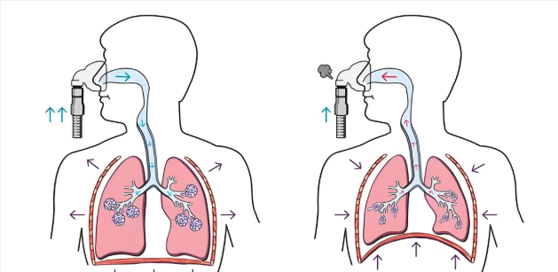 See results in 6 days! "Precision-targeted drugs" are now available for lung diseases; patients with pulmonary nodules and fibrosis shouldn