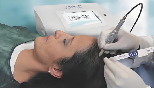 Italian medicap ® Artificial Hair Implant System