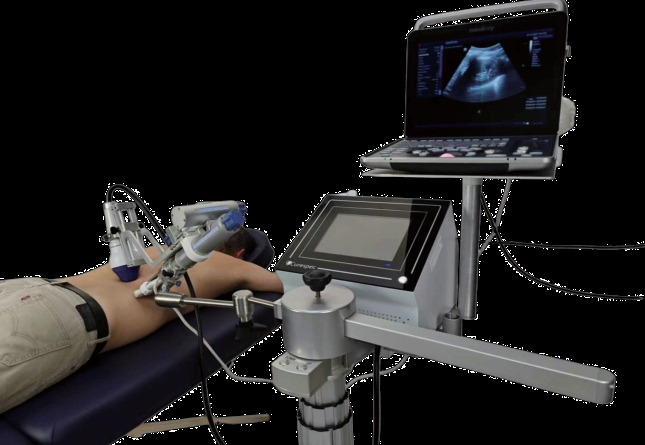 No surgery required! Lecheng