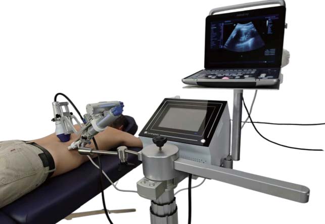Nephrospec Renal Recovery Device (Israel)